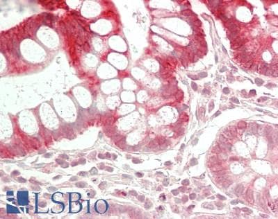 IHC-plus™ CYP4F2 Antibody (N-Terminus)