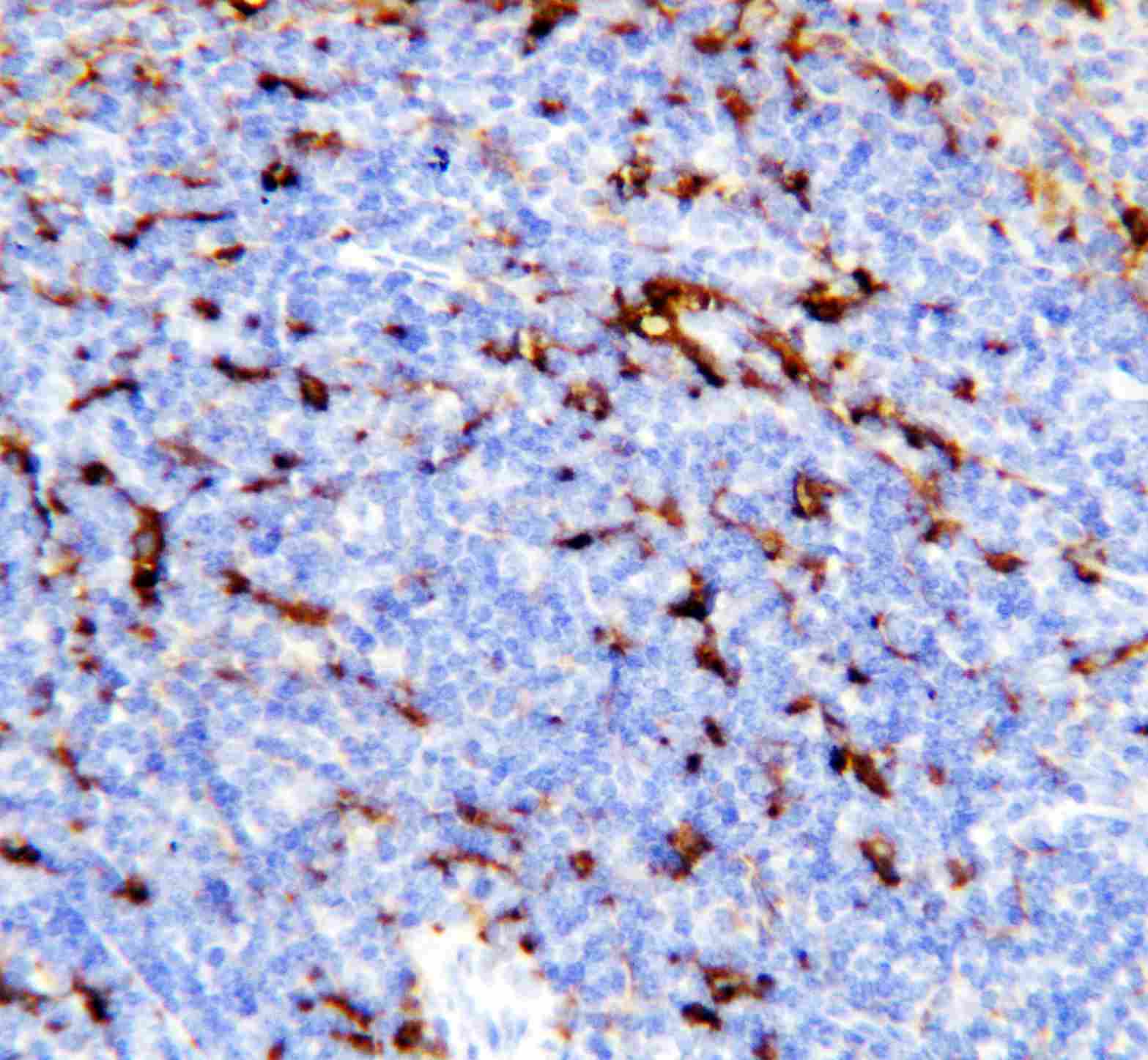 TREM1 Antibody (aa74-90)