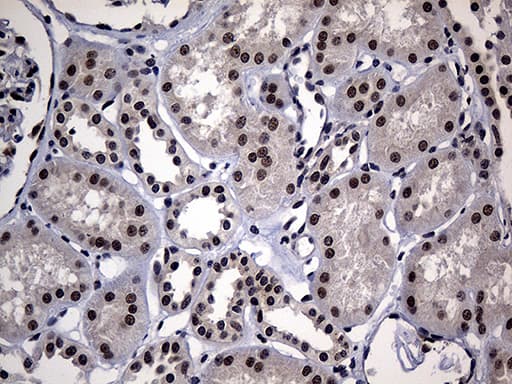 Monoclonal Mouse anti-Human HDAC9 Antibody (clone OTI2A7, aa181-460, IHC, WB)