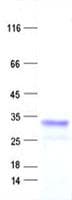 Human GSCL / GSC2 Protein (Recombinant His, N-Terminal)