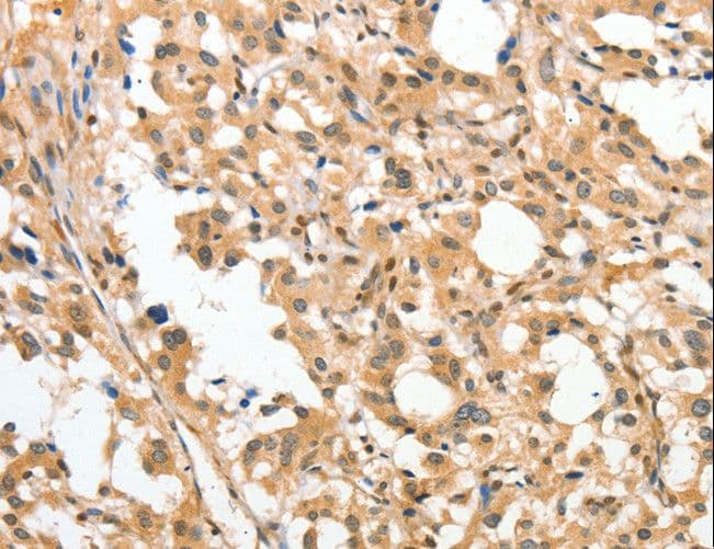 Polyclonal Rabbit anti-Human Aprataxin / APTX Antibody (IHC)