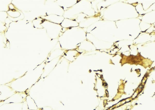 Polyclonal Rabbit anti-Human AGTR1 / AT1 Receptor Antibody (IHC, IF, WB)