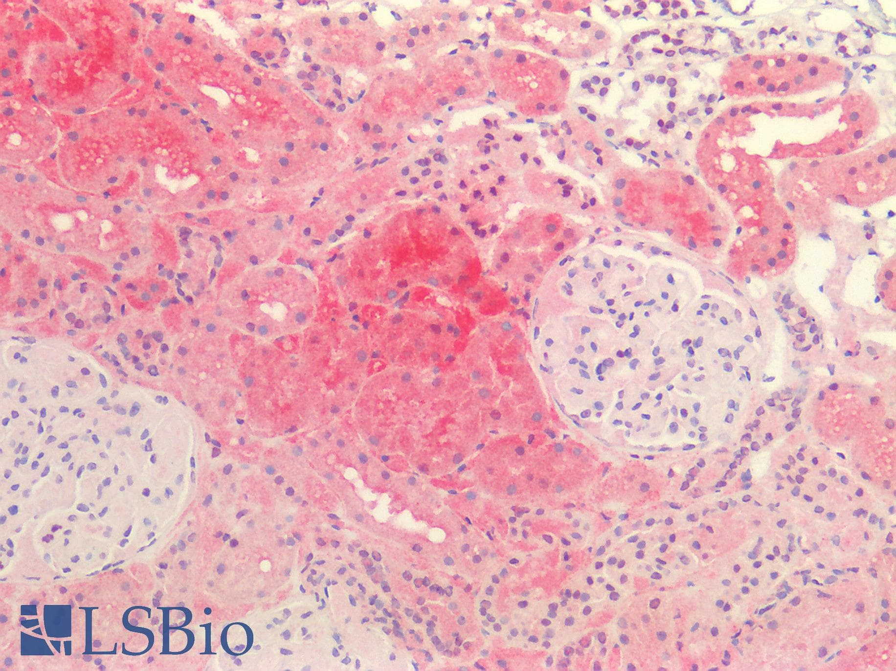 IHC-plus™ EHHADH / Enoyl-Coa Hydratase Antibody (aa662-690)