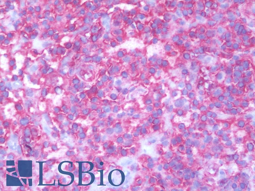 IHC-plus™ HLA-A/B/C Antibody (clone MEM-123)