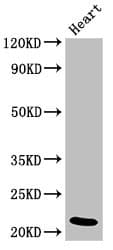 Polyclonal Rabbit anti-Human NDUFB9 Antibody (WB)