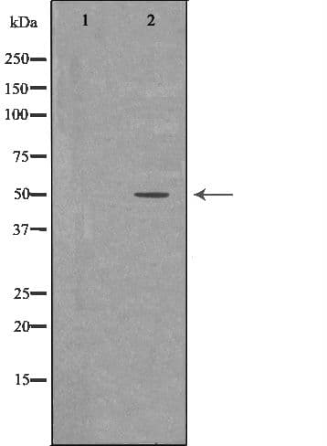 Polyclonal Rabbit anti-Human SGCE Antibody (IHC, WB)