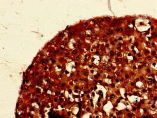 PIGK Antibody