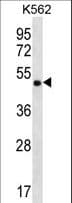 CCDC71 Antibody (aa350-379)