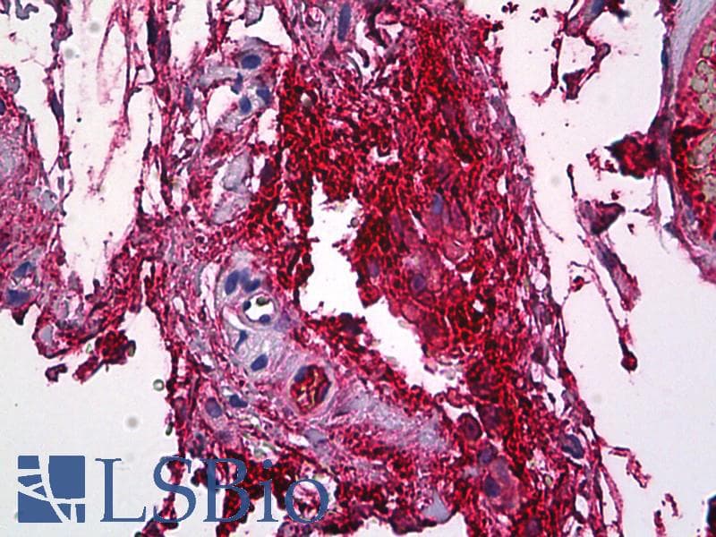 IHC-plus™ FGG / Fibrinogen Gamma Antibody (clone 1F2)