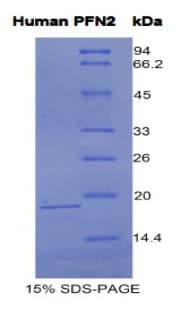 Human PFN2 / Profilin 2 Protein (Recombinant His)