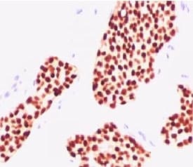 ER Alpha / Estrogen Receptor Antibody (aa2-185, clone NR3Ga-3)