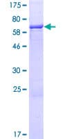 Human RUNDC3B Protein (Recombinant GST)