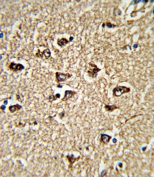 BICC1 Antibody (aa80-107)