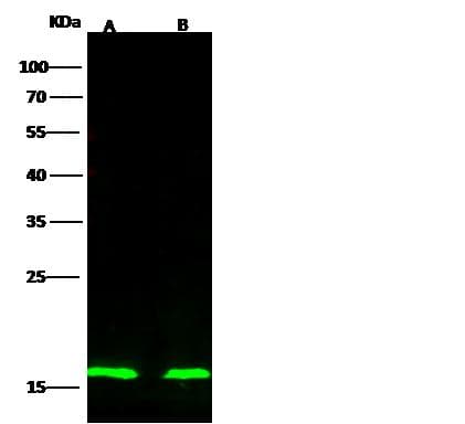 p16INK4a / CDKN2A Antibody (Preservative Free)