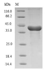 Human HMGCL Protein (Recombinant GST, N-terminus)