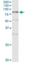 POLA2 / DNA Polymerase Alpha 2 Antibody (clone 2A8)