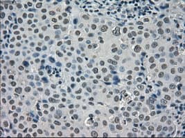 SATB1 Antibody (clone OTI4E1)