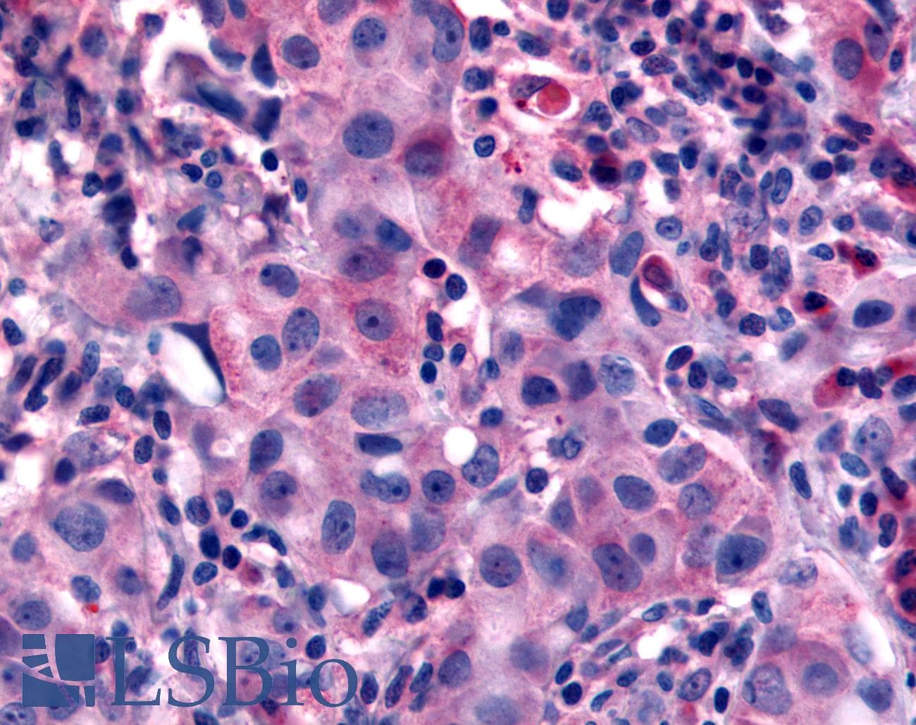 IHC-plus™ Polyclonal Rabbit anti-Human NANP Antibody (N-Terminus, IHC)