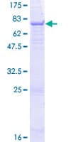 Human PRCP Protein (Recombinant GST)