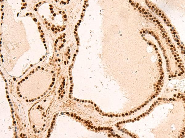 SNRPB2 Antibody