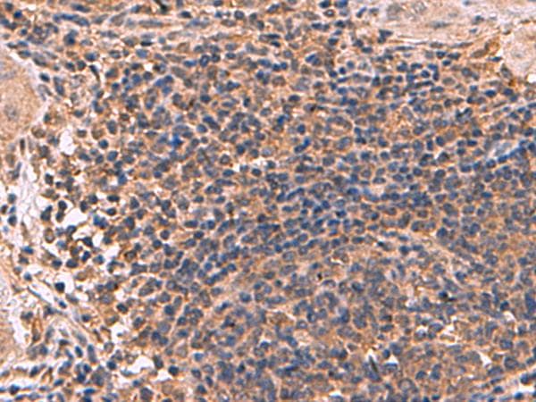 ZBTB33 / Kaiso Antibody