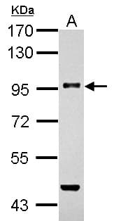 Betaglycan / TGFBR3 Antibody (aa88-314)