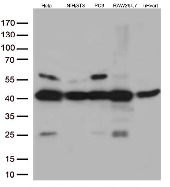 Monoclonal Mouse anti-Human MAPK14 / p38 Antibody (clone OTI5A6, Carrier-free, aa2-360, WB)