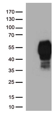 PDCD1 / CD279 / PD-1 Antibody (clone UMAB222)