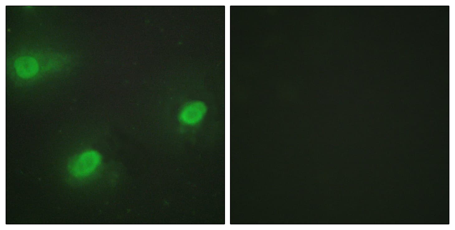 CSTF2 / CstF-64 Antibody (aa11-60)