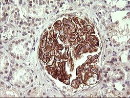 ICAM-1 / CD54 Antibody (clone OTI2H4, Carrier-free)