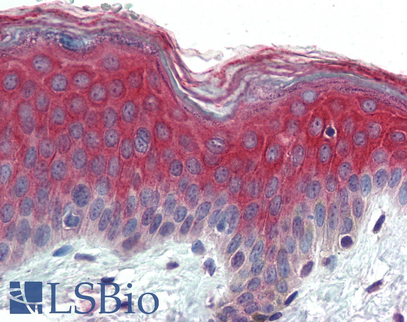IHC-plus™ Polyclonal Rabbit anti-Human ITGA3 / CD49c Antibody (N-Terminus, IHC)