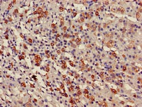 USP6NL Antibody