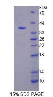 Human RGS9 Protein (Recombinant)