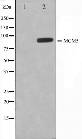 Polyclonal Rabbit anti-Human MCM5 Antibody (IHC, IF, WB)