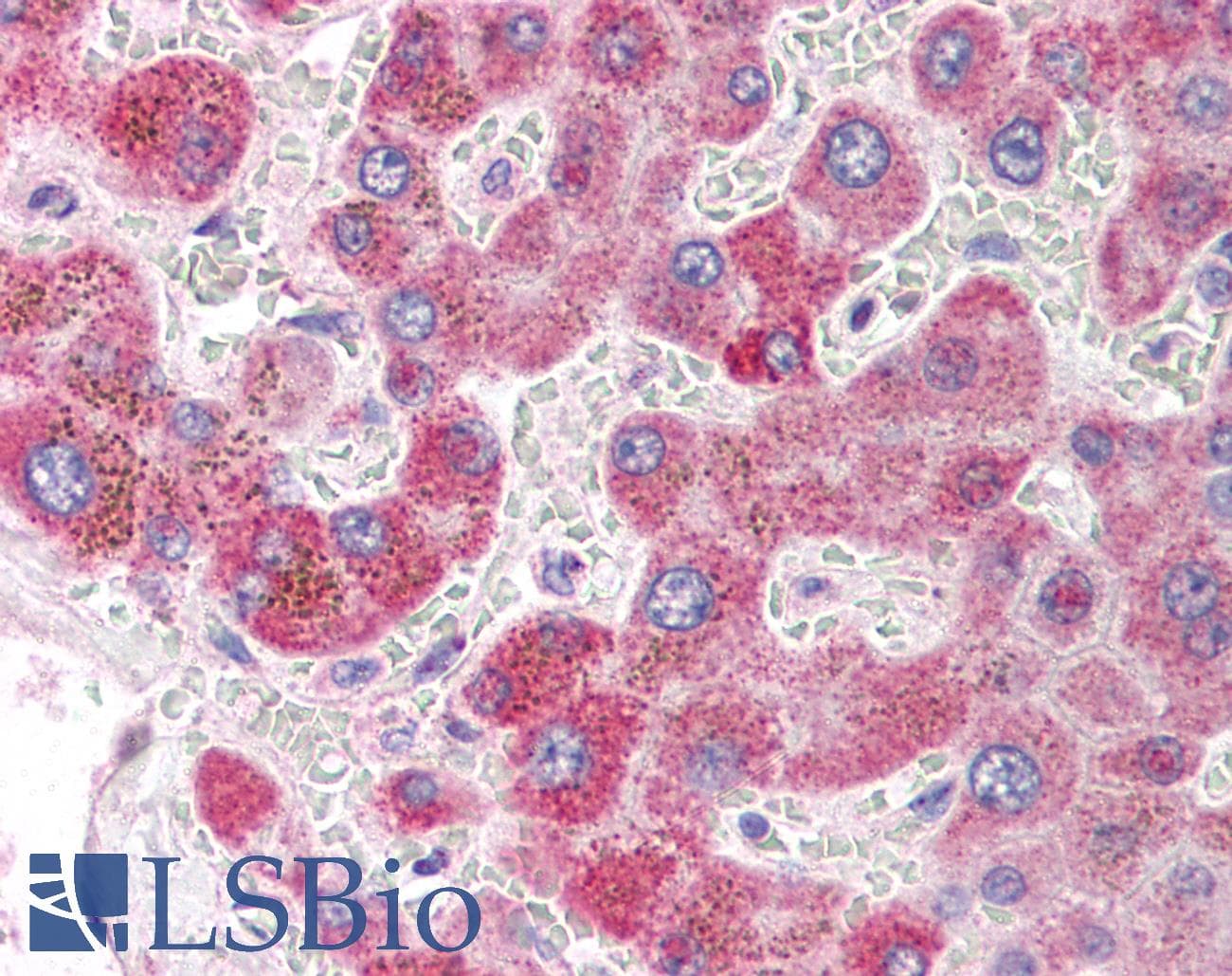 Polyclonal Rabbit anti-Human LAMP1 / CD107a Antibody (IHC, IF, WB)