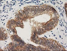 CTNNB1 / Beta Catenin Antibody (clone OTI1E10, Carrier-free)