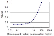 SLC25A16 / GDA / Graves Antibody (clone 1H7)