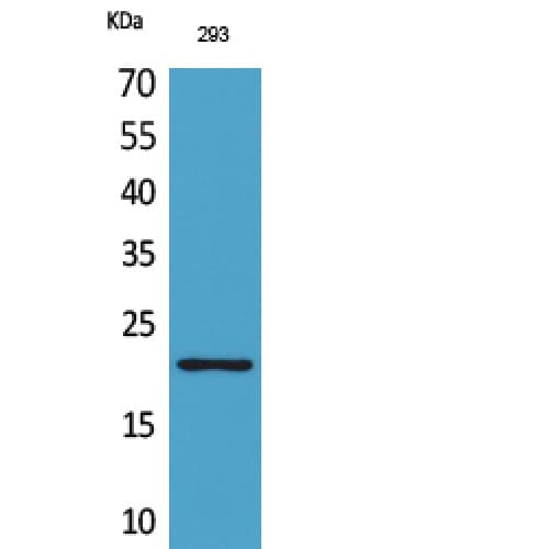 MANF / ARMET Antibody (1-50 aa, Internal)
