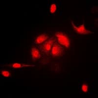 Polyclonal Rabbit anti-Human N6AMT1 Antibody (IF, WB)