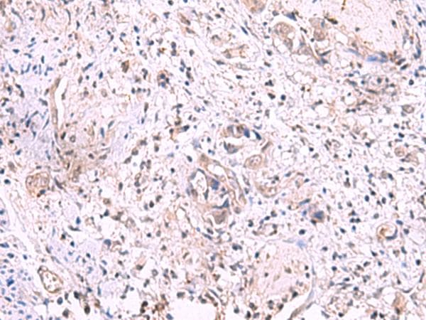 KIR3DL1 Antibody