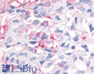 PathPlus™ Polyclonal Rabbit anti-Human ESRRG / ERR Gamma Antibody (N-Terminus, IHC)