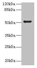 Polyclonal Rabbit anti-Human SLC46A3 Antibody (IHC, WB)