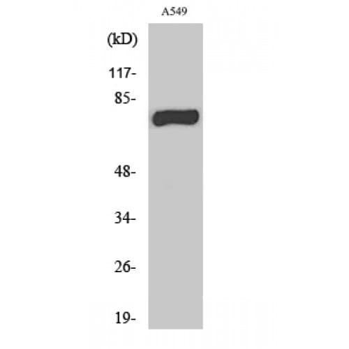 Polyclonal Rabbit anti-Human MPHOSPH9 Antibody (510-590 aa, C-terminal, WB)