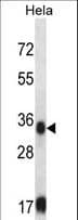 SORD / Sorbitol Dehydrogenase Antibody (aa211-239)