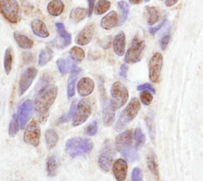 COAA / RBM14 Antibody (aa150-200)