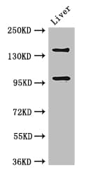 PHLDB2 Antibody