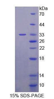 Human UPB1 Protein (Recombinant His-T7)
