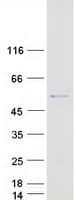 Human PNLIPRP1 Protein (Recombinant Myc-DDK (Flag))