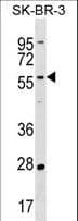 TAF6L Antibody (aa77-103)