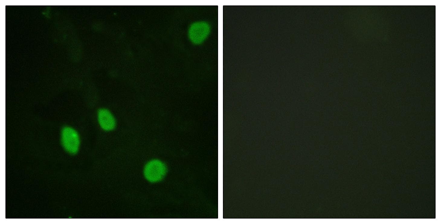 Polyclonal Rabbit anti-Human CCNH / Cyclin H Antibody (p315, IHC, IF, WB)